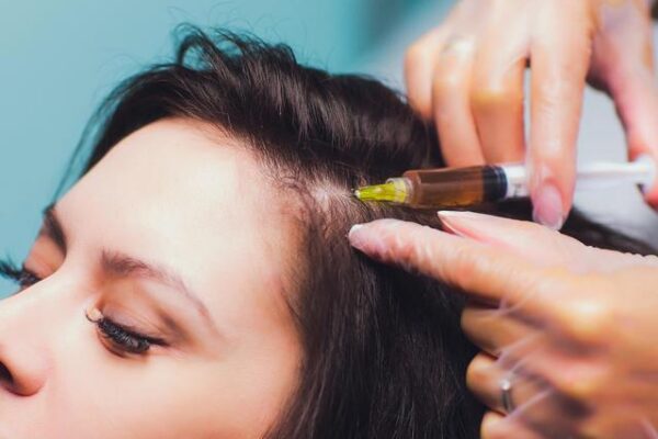 PRP: traitement miracle ou onéreux effet de mode?